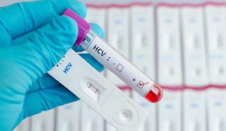 Sangue infetto:il Ministero è responsabile delle emotrasfusio...