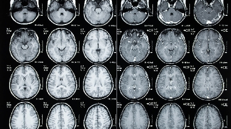 Uso illecito di trattamento dei dati di accertamenti medici.