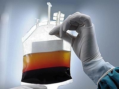 Danni derivanti da emotrasfusioni con sangue infetto.