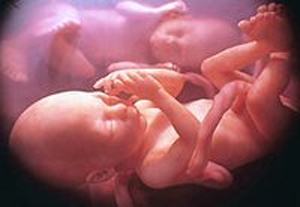 Portogallo. Il legame tra gemelli è sacro come quello con la ...